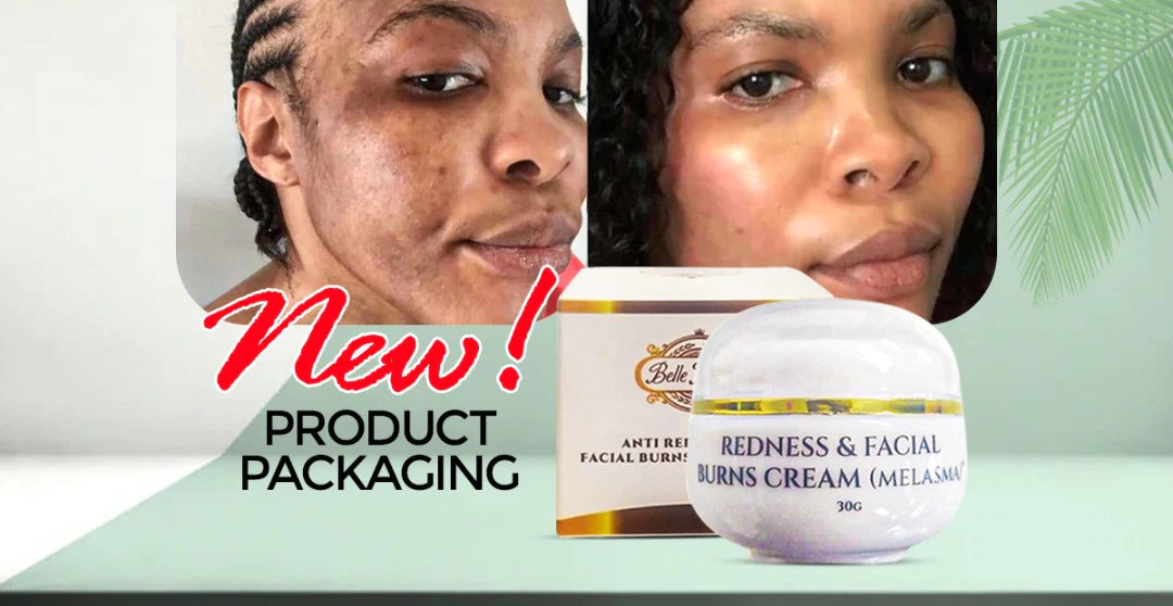 NEW REDNESS & BURN SET (PERFECT FOR MELASMA)